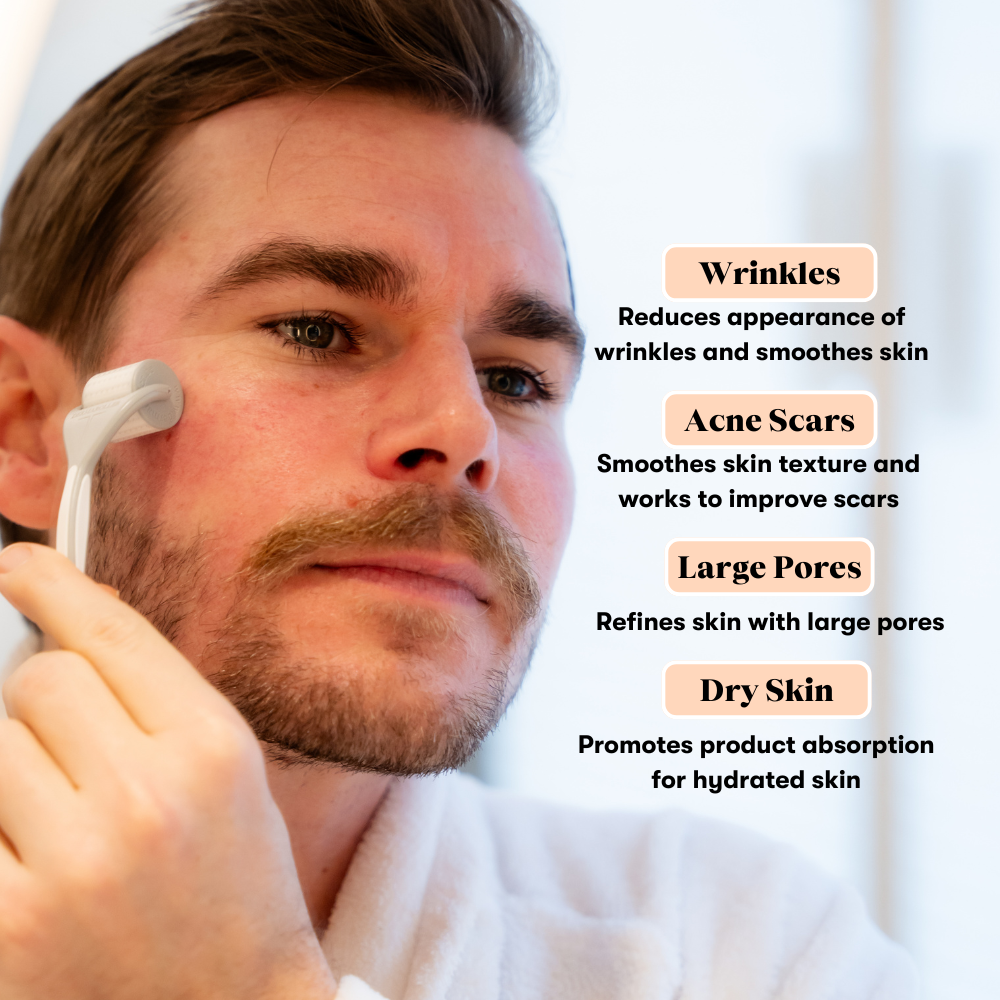 The Original Dermaroller